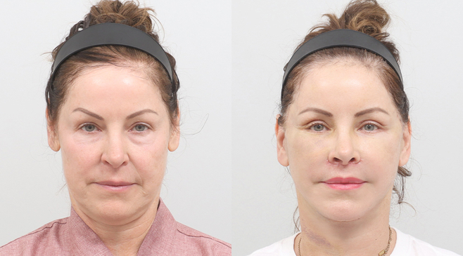 Slider image (4) AB Plastic Surgery